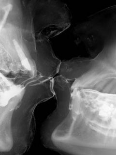 Poljubac uhvaćen na rendgenu :))  #dentistry #kiss