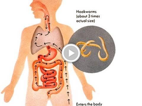 OffTheEdgeHumor's tweet photo. Top 10 Weirdest Diseases https://t.co/sCdrJcA8fZ #staged https://t.co/1M3R6xJVXz