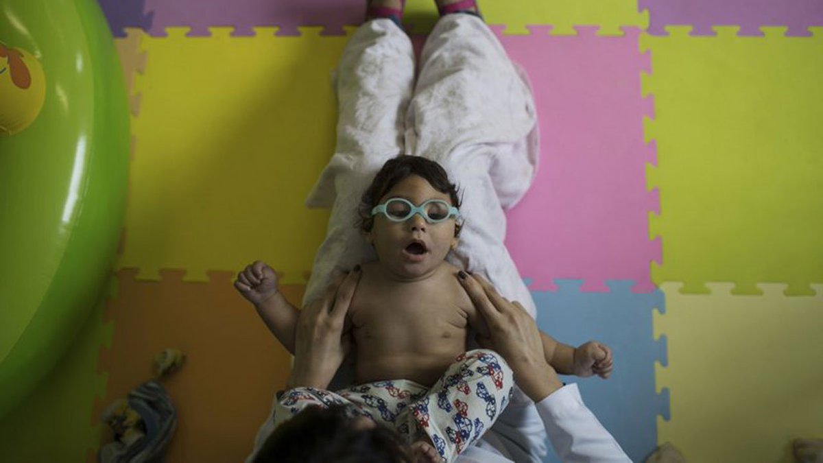 As babies stricken by #Zika turn 1, health problems mount bit.ly/2dLrirr?utm_me… https://t.co/VZNU0oi1dZ