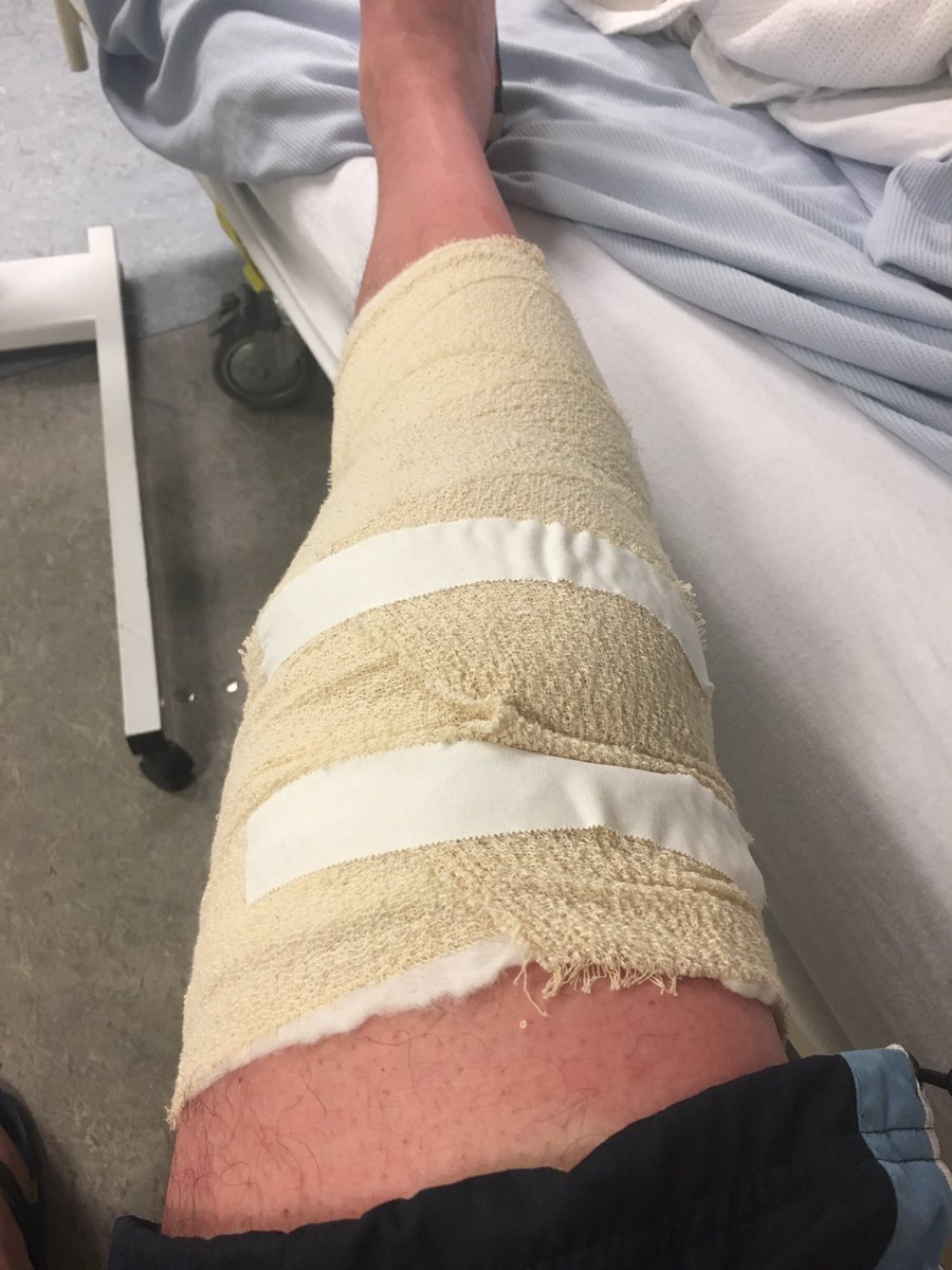 Wilkinson_Golf's tweet photo. I am unfit to run @realDonaldTrump lol. Soon as knee is fixed #ailsa @TrumpTurnberry is #no1 on my list #sgtw2016 #roadtorecovery https://t.co/8drMDAJt7o