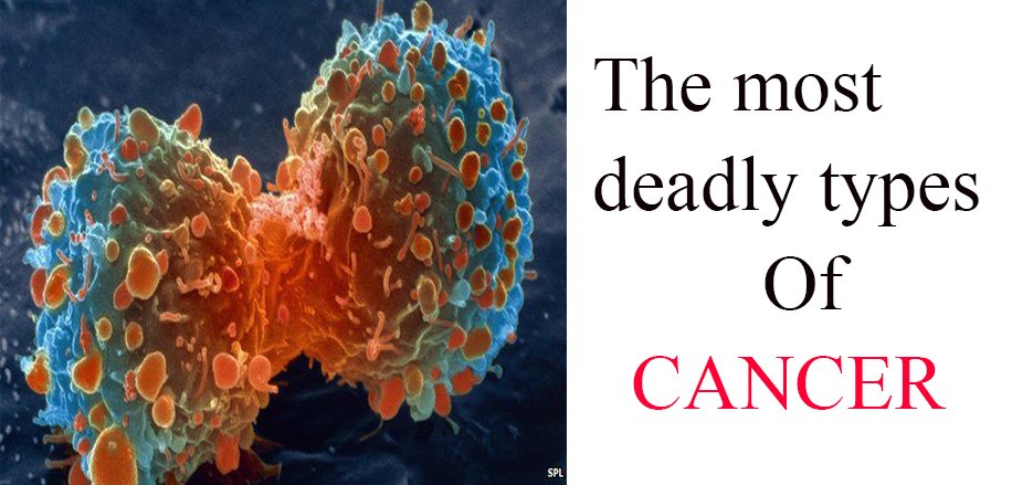 Healthkept's tweet image. The #most dangerous types of #Cancer #Mustcheck
#diseases #coloncancer 
&amp;gt;&amp;gt;&amp;gt;&amp;gt; goo.gl/YHmRzu &amp;lt;&amp;lt;&amp;lt;&amp;lt;