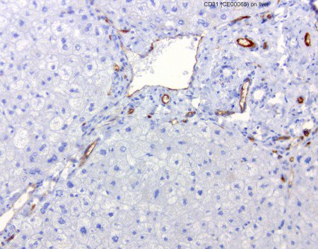novogencomtr's tweet photo. CD31 Mouse Monoclonal Clone: UMAB32
https://t.co/eNEkBhKvz2
#cd31antibody #cd31pathologyantibody #cd31patolojiantikor #cloneumab32 #sdix https://t.co/zoAY5Av3pV