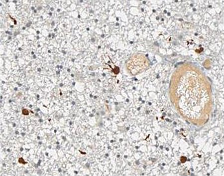 novogencomtr's tweet photo. Anti-IDH1 R132H (Hu) from Mouse (Clone: H09)
https://t.co/YBx63iNZeg
#idh1r132hantibody #idh1pathologyantibody #idh1patolojiantikoru https://t.co/3p2FGFbg3o