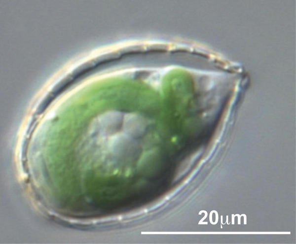 QuoRevista's tweet photo. La ameba que se tragó una bacteria para ser fotosintética https://t.co/u8rXTKBAsQ https://t.co/Ptc3S3KQXm