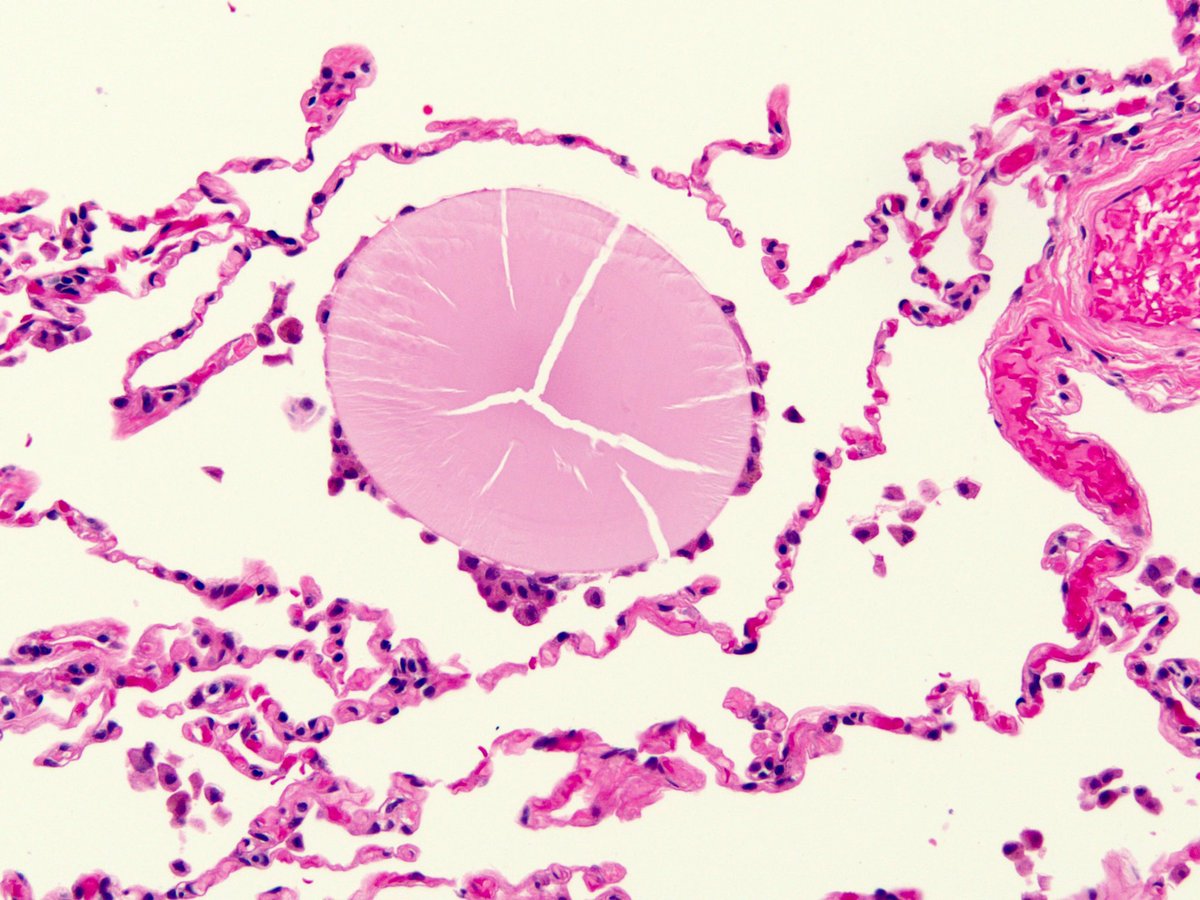 smlungpathguy tweet picture