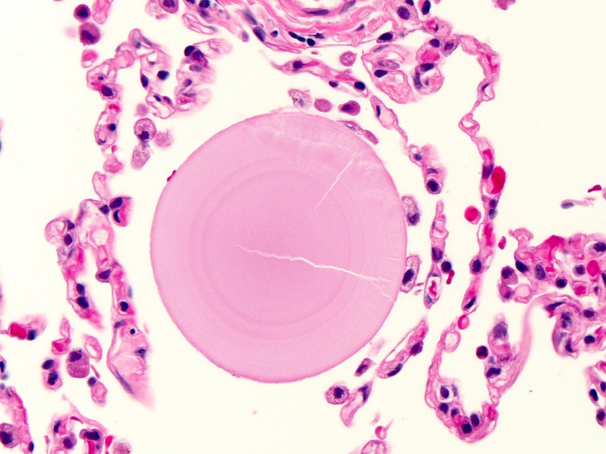 smlungpathguy tweet picture