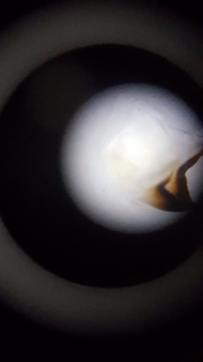 semenek's tweet photo. Science! Squid beaks with #wsdscience https://t.co/Jjrpsng5tV