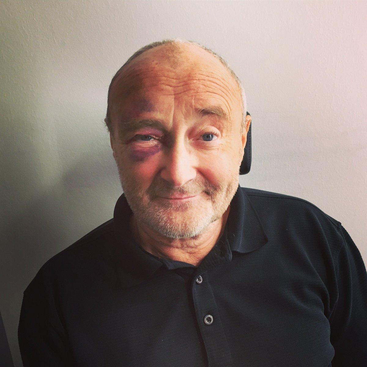 Unfortunately Phil bumped his head on Wed night - he wanted you all to know he's ok and soldiering on.
We wish him a speedy recovery!