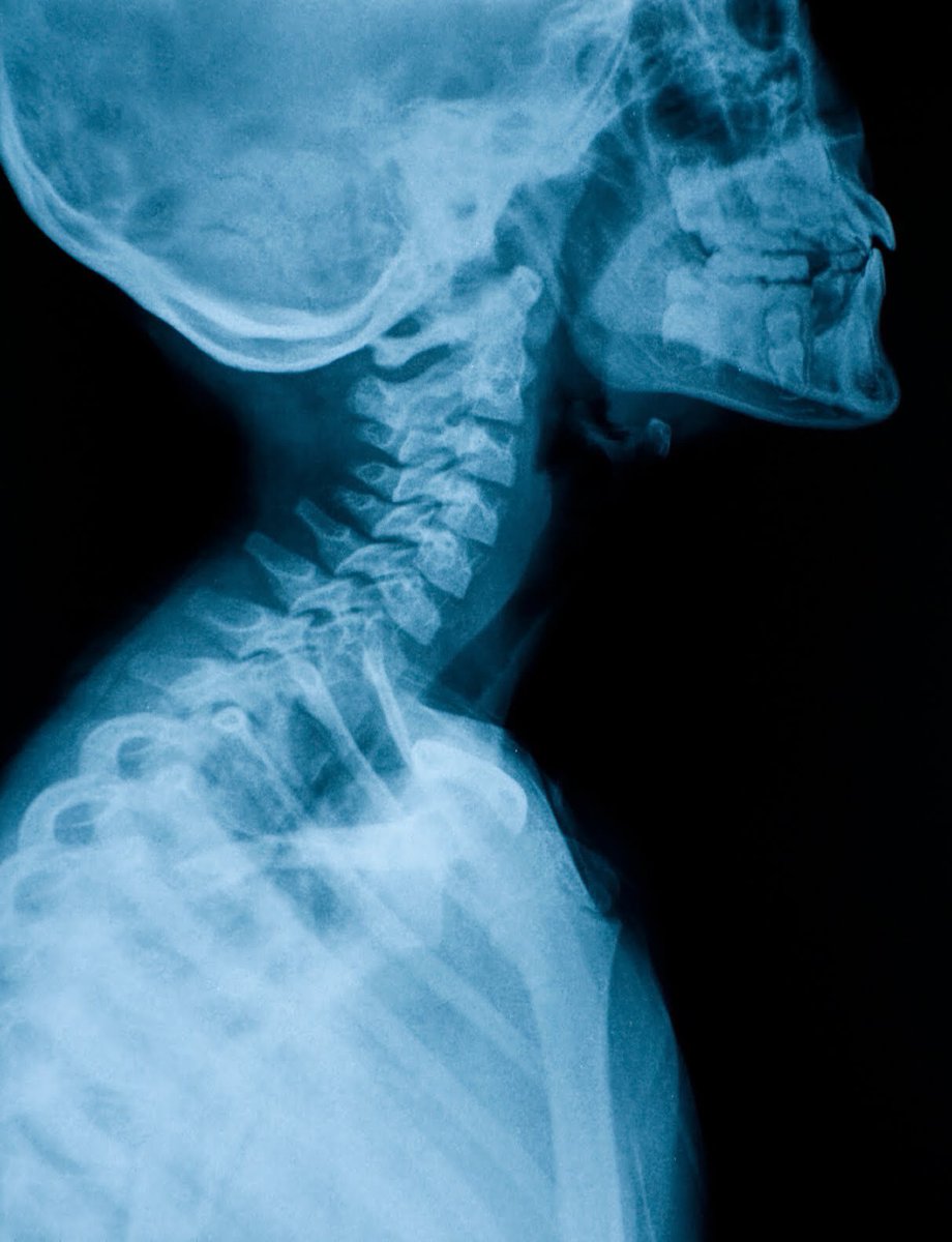 sportingtherapy's tweet photo. #sportingtherapyknowledge Another good listen...@TPMPodcast #34: 'Cervicogenic Headache' @DrTobyHall & @Chews_Health https://t.co/XhOlBEdbVs https://t.co/rGSIw0oeBT