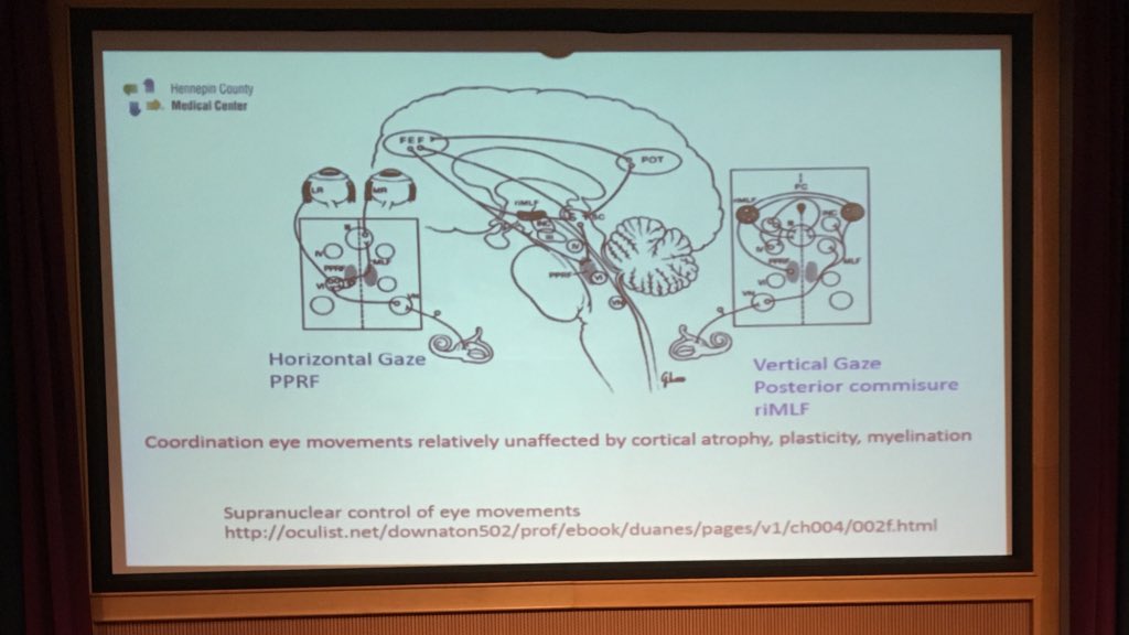 PinkConcussions's tweet photo. Coordination of eye #Samadani #NIHpediTBI https://t.co/sbboGiwCLF