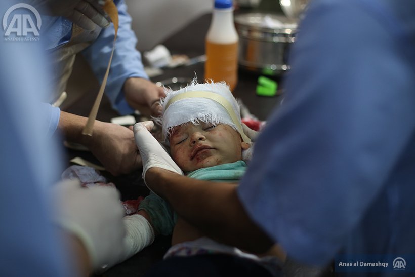 ritakhoury10's tweet photo. #Syrian #baby receives a medical treatment after #aistrike over residential areas in #Damascus https://t.co/4BnMrbxxv6