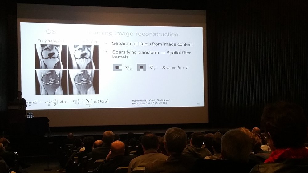 i2iworkshop's tweet photo. Dr. Knoll on using #deeplearning for image reconstruction to reach 5-minute knee #MRI. #biomedicalimaging #innovation #i2iworkshop https://t.co/w8Wjadn5Wg
