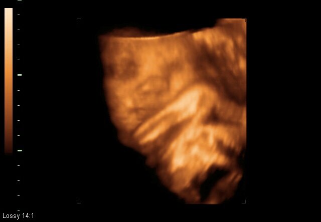 Pookey2007's tweet photo. #31Weeks6Days #3D image of my #babyboy ❤❤❤ I'm so in love.. #MommyToBe #Pregnant #Pregnancy #Motherhood https://t.co/fPw4rw8kKT