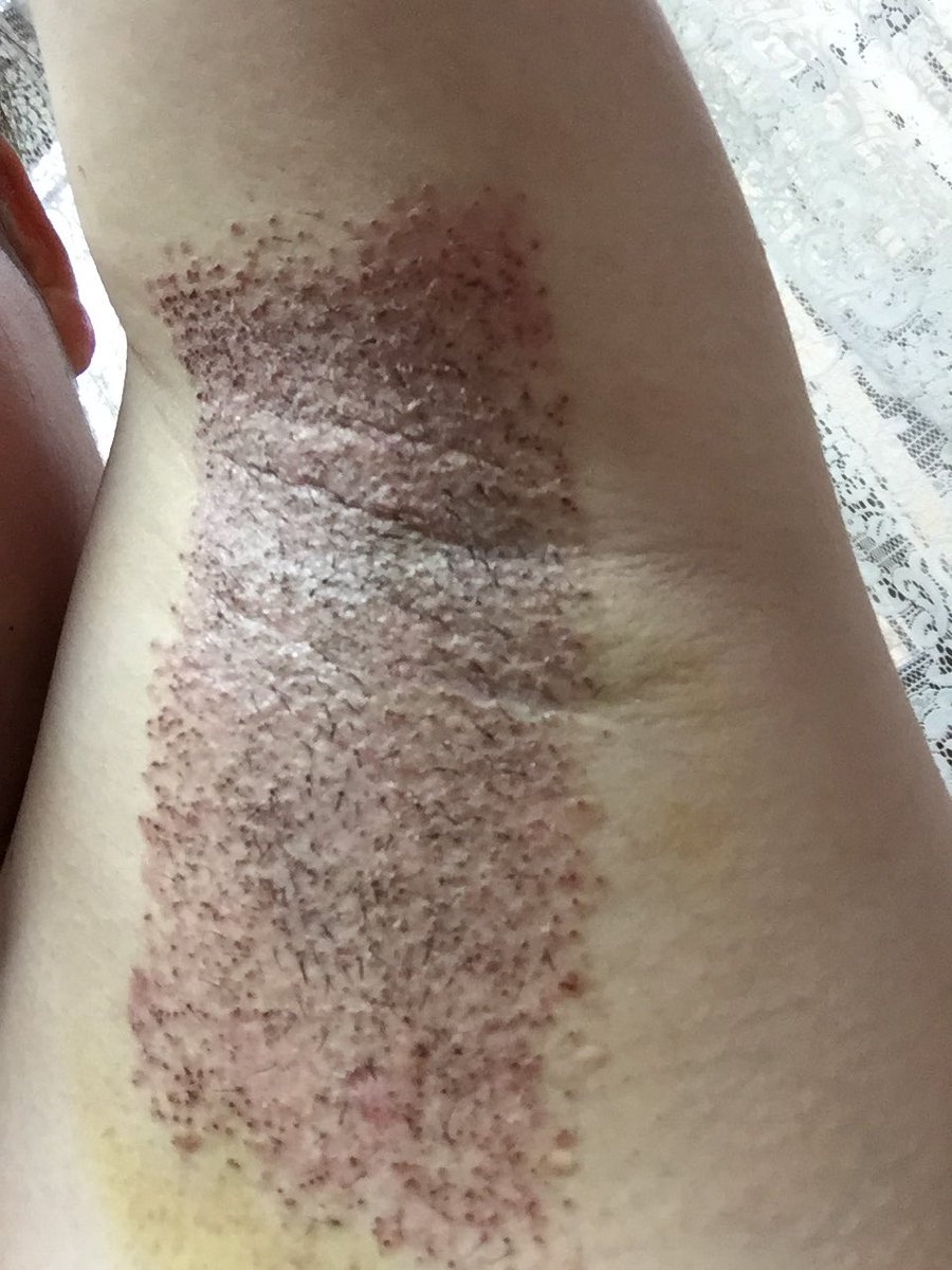 ワキガール ビューホット受けました Wak1gail Twitter