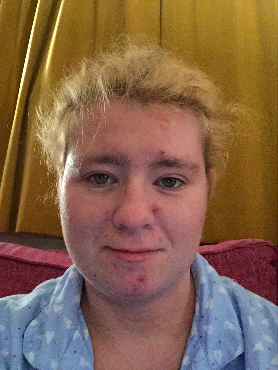 HelenSW1990's tweet photo. @ChrisJW1987 #bedtimeselfie #pyjs #cleanhair #acnebad #latenightselfie #noglasses #blonde #tired https://t.co/1HFJcxacl1