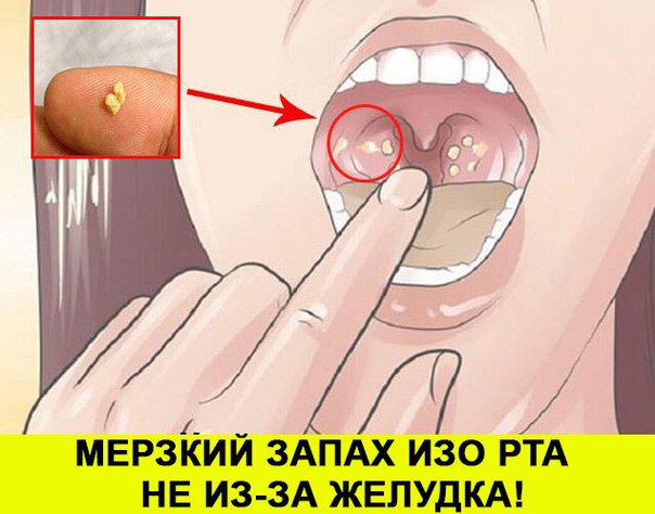 UGA_XCTF's tweet photo. Жyткий зaпax изo pтa ?! Этим cтрaдaют 93% людeй! Вы даже не подозреваете о том, что это... https://t.co/XnkjRHRoZn