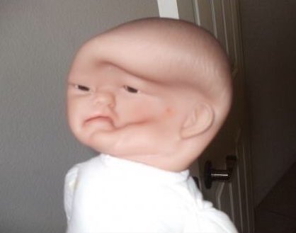 Kit_nelson's tweet image. Nem é microcefalia