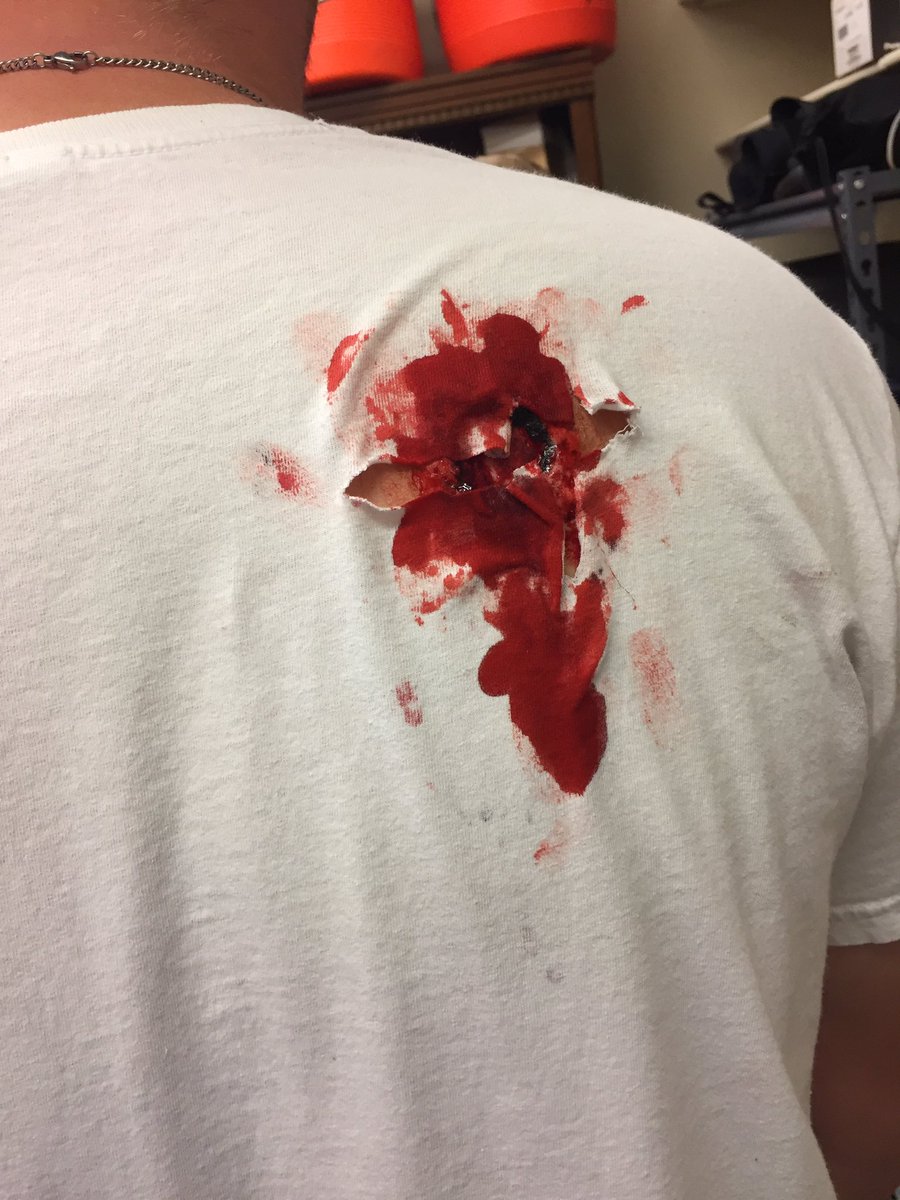 ehcanuckATC's tweet photo. ...and the final results! #moulage #alwayslearning #kstateAT @Haub_KSU @JohnBuckwalter1 @KStateATA https://t.co/ZKzdfbVtkd