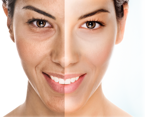 SkinSutraMedSpa's tweet photo. Look at the difference a OxyGeneo Facial can make. #OxyGeneo #Facial #Fairfax #MedSpa #SkinClearing #Brightening #Rejuvinating https://t.co/roqk3mhnj6