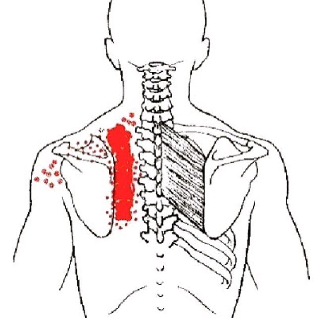 عنوان مرفق الكتف بالليزر الكتف Dsvdedommel Com