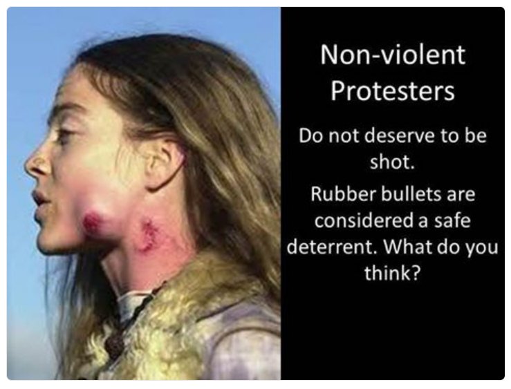 TammyKosiancic's tweet photo. .@jimmy_dore I guess 'grabbing pussies' is worse than shooting peaceful environmentalists in the face? #NoDAPL https://t.co/kjDI0dl6XT