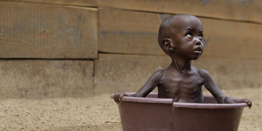 CelineKashi's tweet photo. Une pensée pour ces enfants souffrant de mal nutrition.
https://t.co/dUze47Nwj0 #enfantsmalnourris https://t.co/UakTda8AIJ