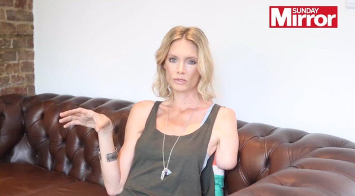 StuntPlayers's tweet photo. Olivia Jackson refuses to have negative attitude after having her arm amputated after an accident on #ResidentEvil: https://t.co/sCEBCDo7ga https://t.co/q1TXeRFpDS