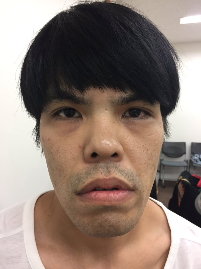 ブサイク芸人の新生 ロビンソンズ 北澤のゴリラ顔が気になる Wiki風まとめとネタ動画