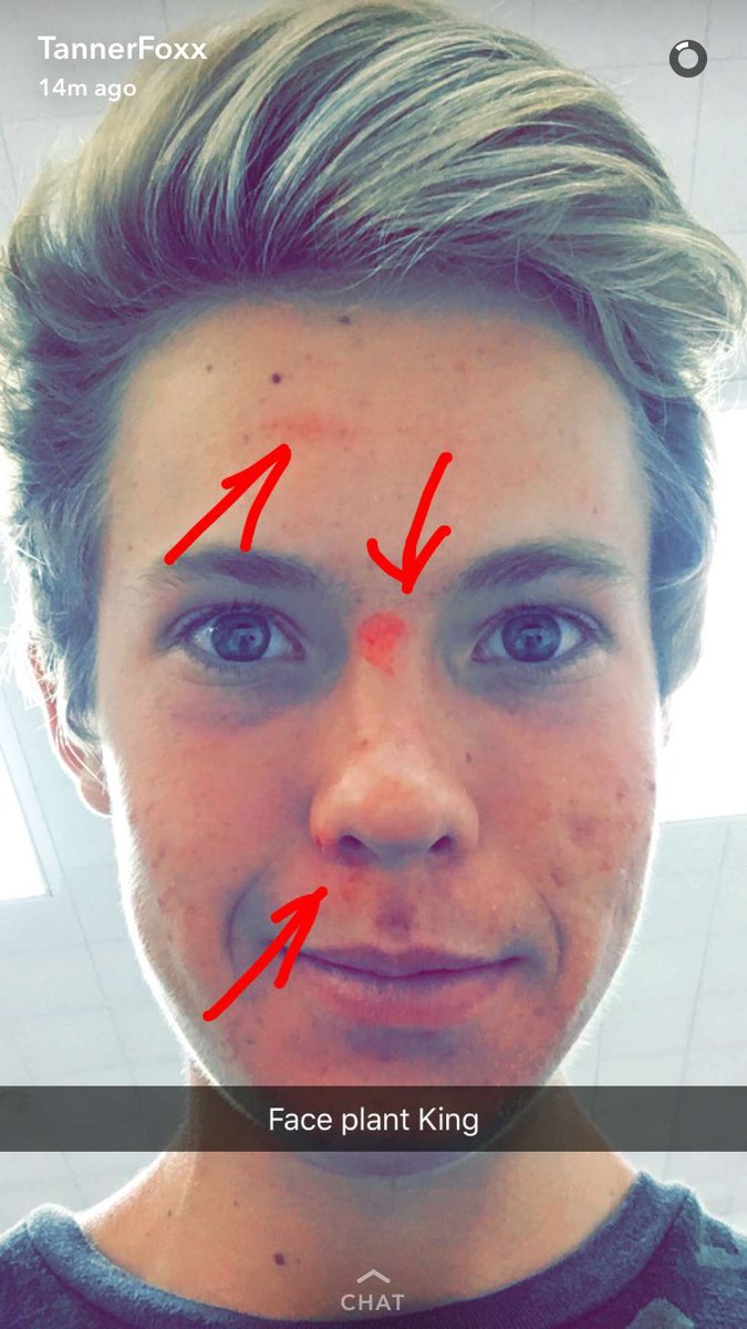 tanner fox on twitter i face planted so hard tonight at the