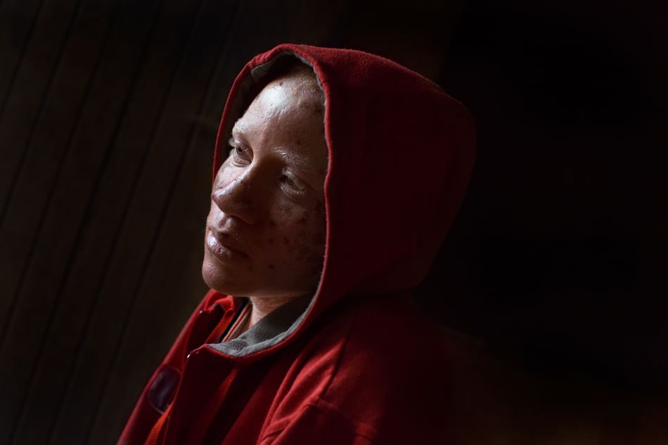 AAStrappo's tweet photo. Zeruzeru, di @immordino70 
https://t.co/A6W0yGbCMT
#albino #Africa @58clotilde @adelaidemoru61 @moni_gent @togamb @adelemusso @VondoriIrene https://t.co/hZpXHdVtN6