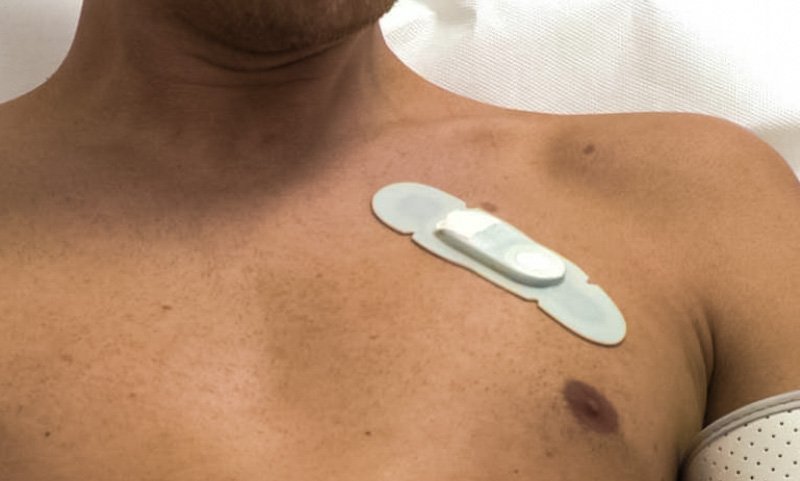 Het Slingeland Ziekenhuis experimenteert met slimme pleisters goo.gl/bZx0og #icthealth #innovatie <a href="/Slingeland_ZH/">SlingelandZiekenhuis</a>