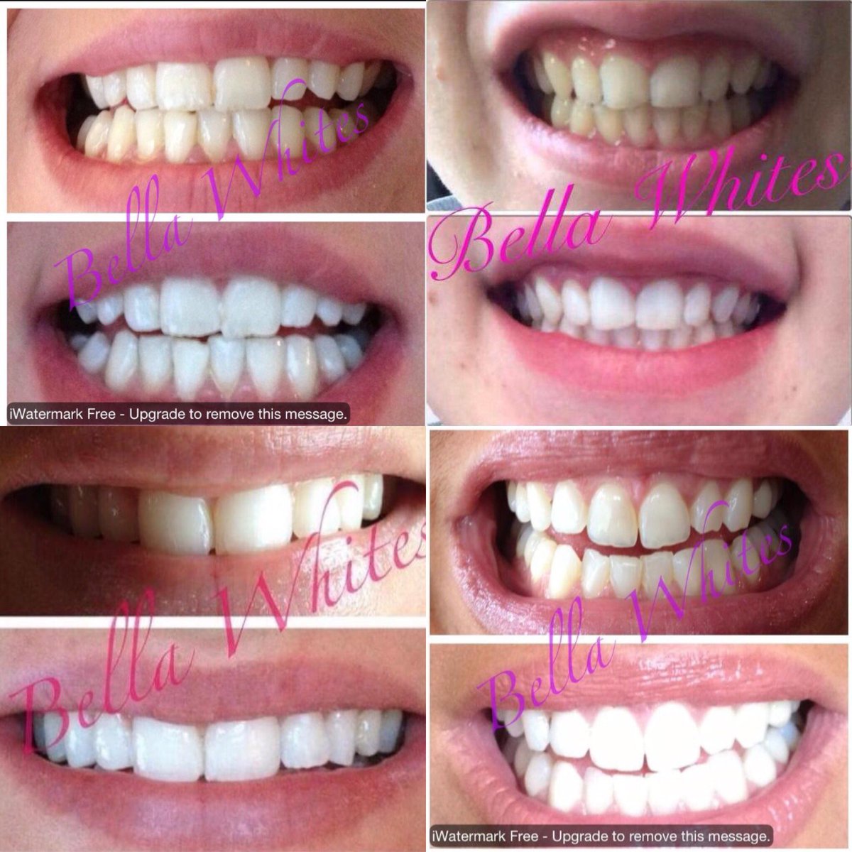bella_whites's tweet photo. Busy day making beautiful white smiles #teethwhitening https://t.co/jbrbFyPB72
