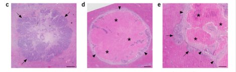NatureMedicine's tweet photo. Vessel co-option mediates resistance to anti-angiogenic therapy in liver metastases: https://t.co/gB7yjBOxKb #cancer #livercancer https://t.co/nzxP7bQdef