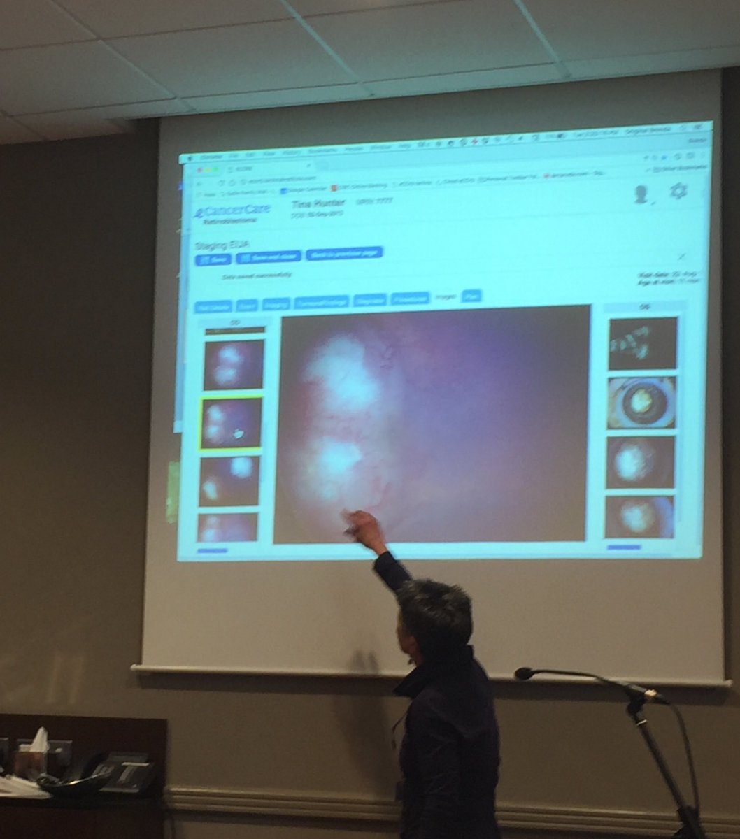 HDimaras's tweet photo. Dr Brenda Gallie displays the cool new features of eCancerCare #retinoblastoma, a disease-specific electronic point-of-care medical record https://t.co/7naR9IdRhY