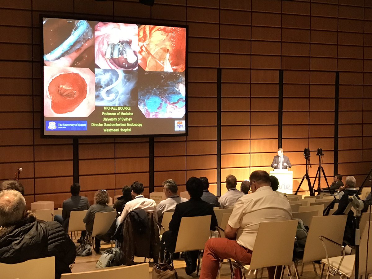 #UEGweek #UEGW Prof Michael Bourke delivers a state of the art lecture on Endoscopic resection in Barrett's with ideas for future direction