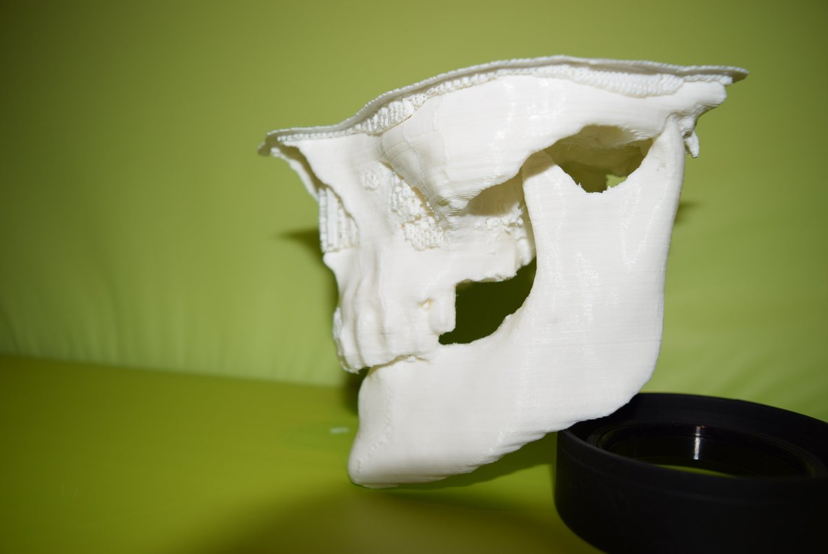 Printmed_3D's tweet photo. #print3D #printForMedicine #Printmed3d https://t.co/vtS1TS91v6