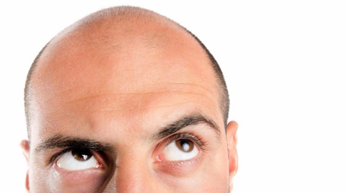 healthtipstic's tweet photo. Hair Transplantation: Check out the Certain Myths Around It at https://t.co/walszpei0O

#hairtransplantation #haircare #healthtipsoftheday https://t.co/4u6zBp2ENu