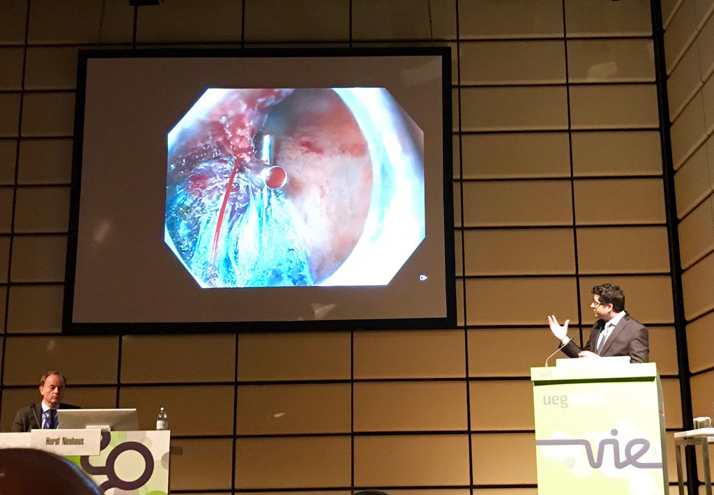 #UEGWeek Dr Sidhu demonstrates how not to panic under pressure, major bleeding during ESD of a gastric NET #SIES2017
