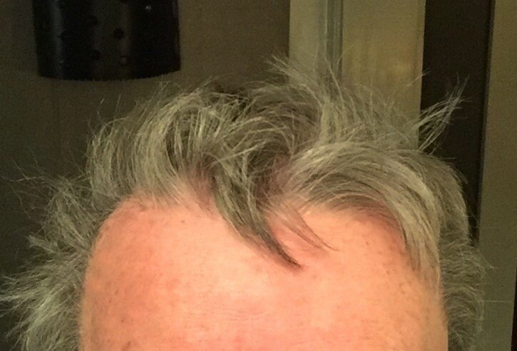 SamDallas's tweet photo. Bad hair day https://t.co/8pO9U4udAZ