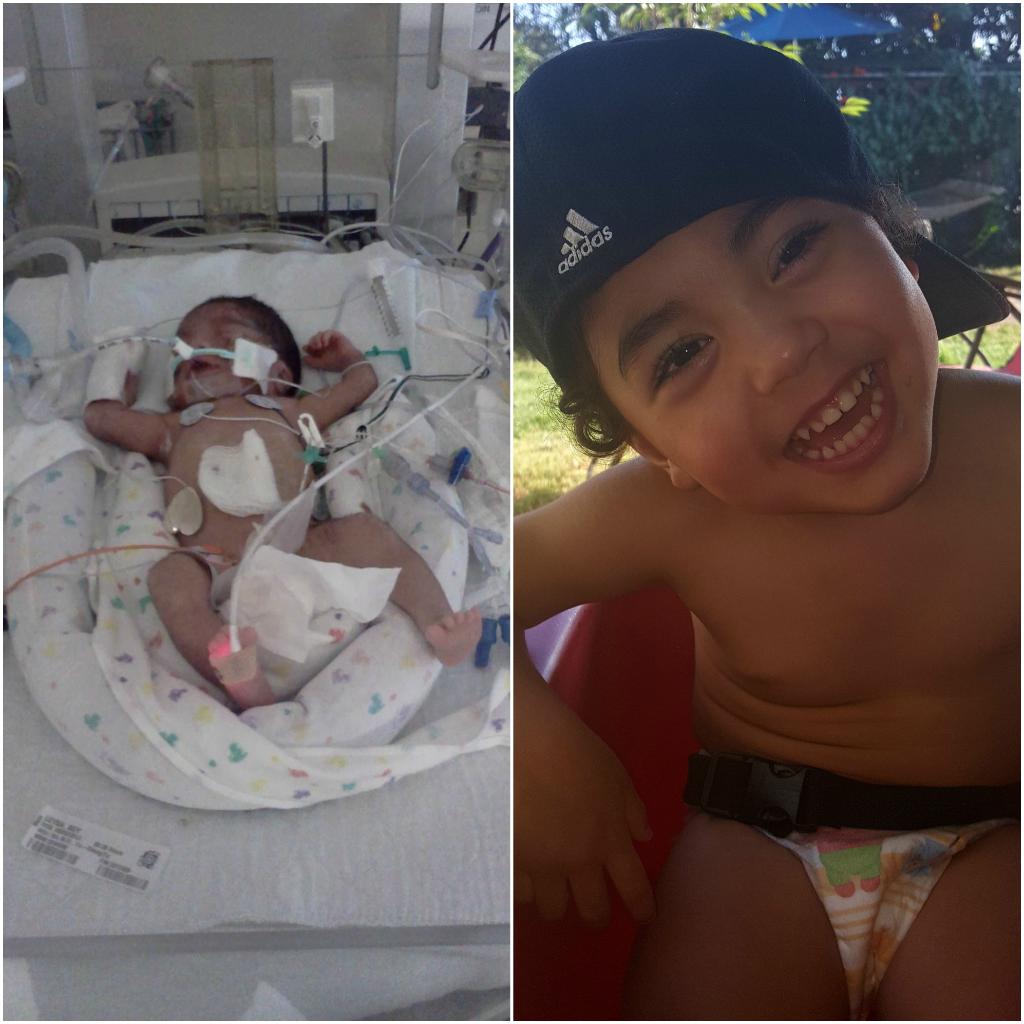 For #NICUtoNow we have Efrain, born at 27 wks.weighing 3lbs. Today he is 3 yrs old and just started preschool! #NICUgrad #givethemtomorrow