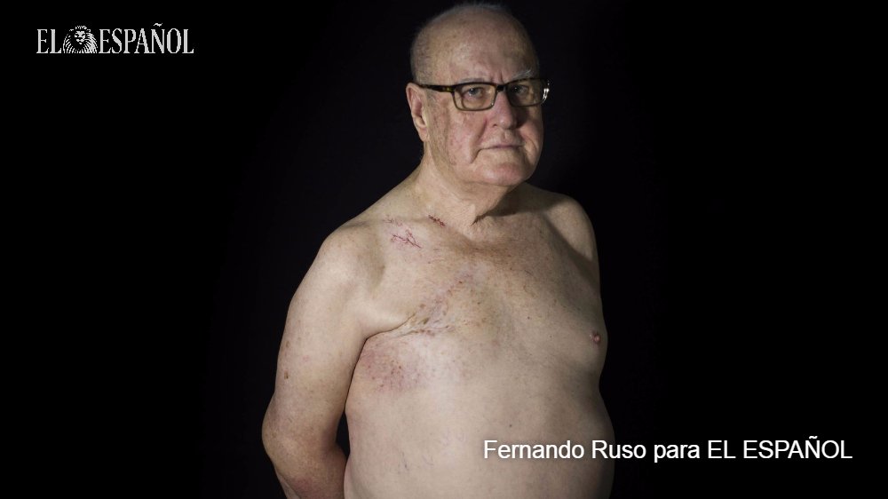 elespanolcom's tweet photo. "Soy Pepe y he sobrevivido a un cáncer de mama" https://t.co/5oAVB1pPO7 Uno de cada cien casos se da en hombres #DiaContraelCancerdeMama https://t.co/aq7ay8RA3u