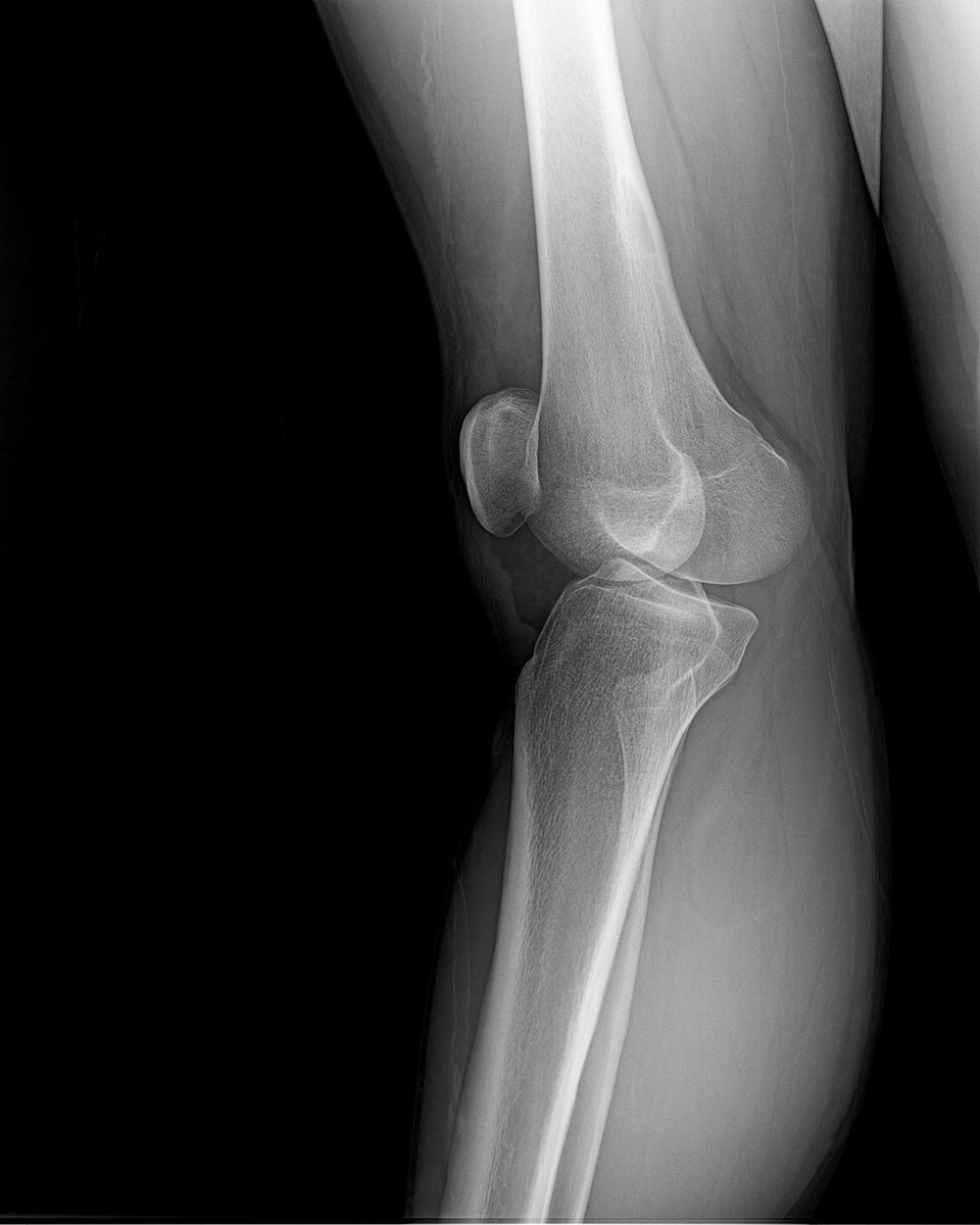 ExploreWithNick's tweet image. Hyperextended knee.... Cool.