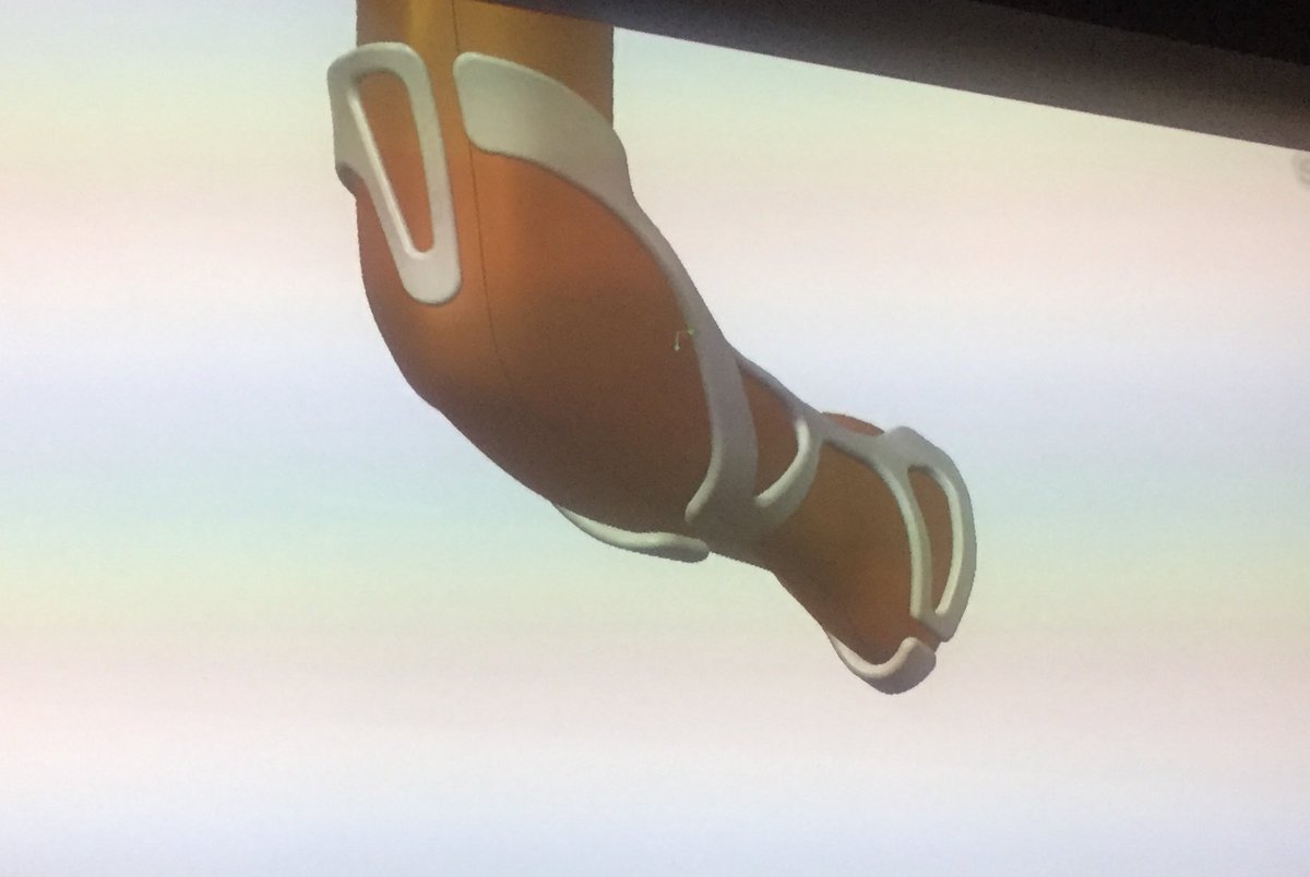 PsychFashionLCF's tweet photo. 2nd speaker #ScottSummit #designer live from US @innovatemedtec #3Dprinting for fractures and torn ligaments #digitalhealth https://t.co/oYMxWDMEBc
