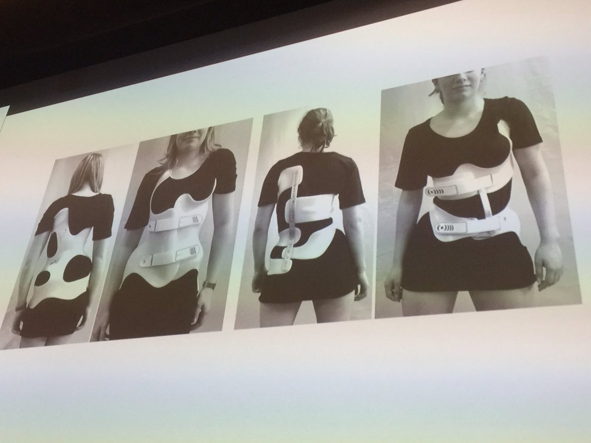 imtinnovation's tweet photo. Beautiful #3dprinting braces for #scoliosis by #Scottsummit #digitalhealth https://t.co/0z6EFLVrLQ
