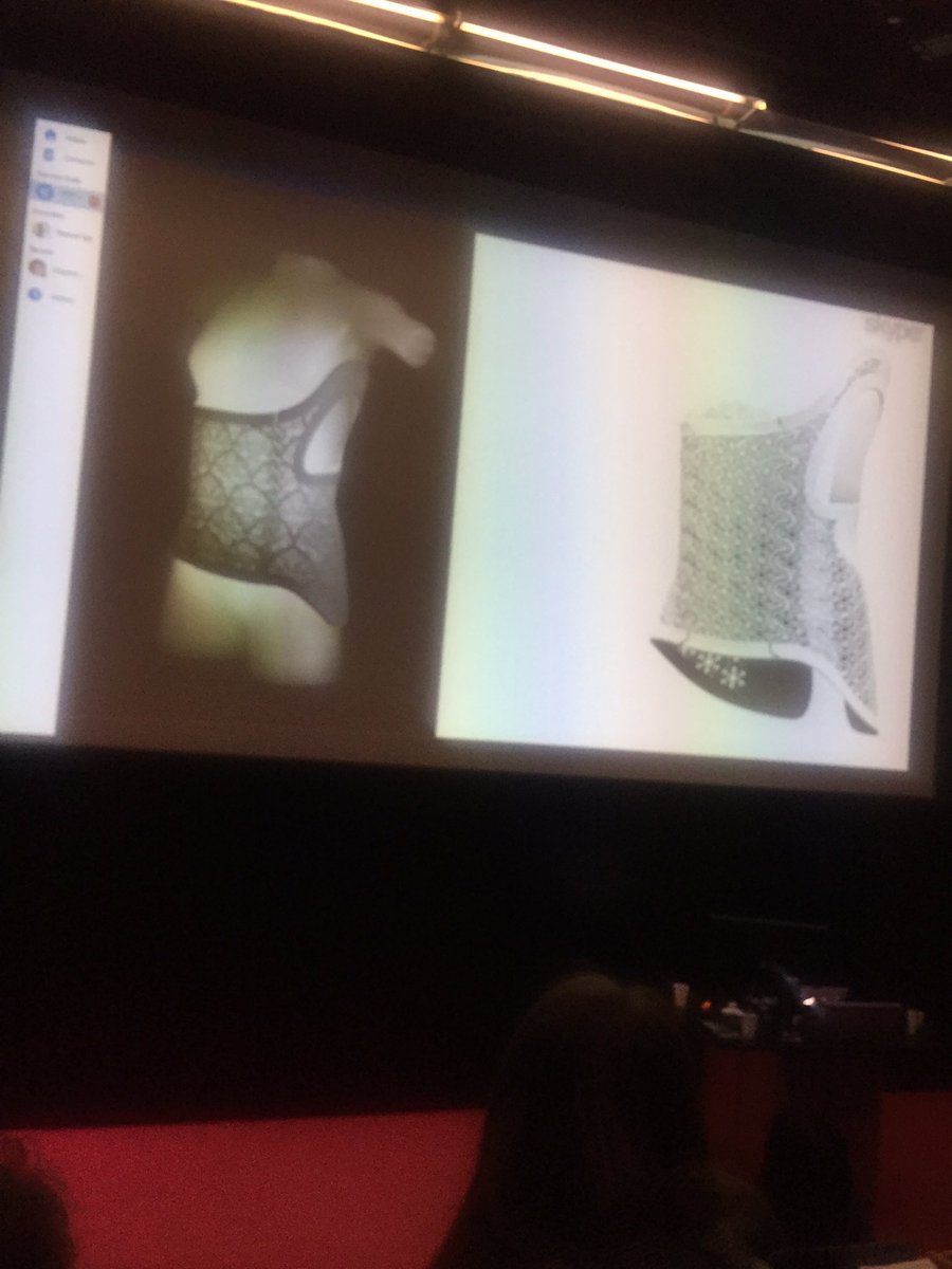 PsychFashionLCF's tweet photo. Wonderful! #ScottSummit @innovatemedtec @LCFLondon #3Dprinting braces for #scoliosis and #prosthetics #Psychology #fashion #wellbeing https://t.co/6Pgr5YrsR0
