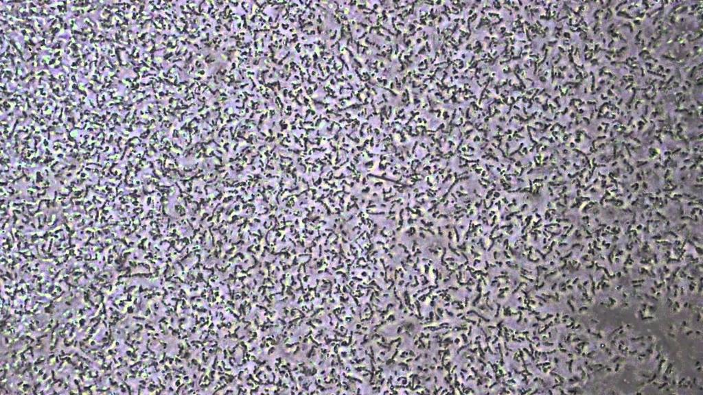 quantumcorp_'s tweet photo. #DidYouKnow There Are More #bacteria On The Human Body Then There Is Humans On Planet Earth Itself. https://t.co/0YCVKyxXg2