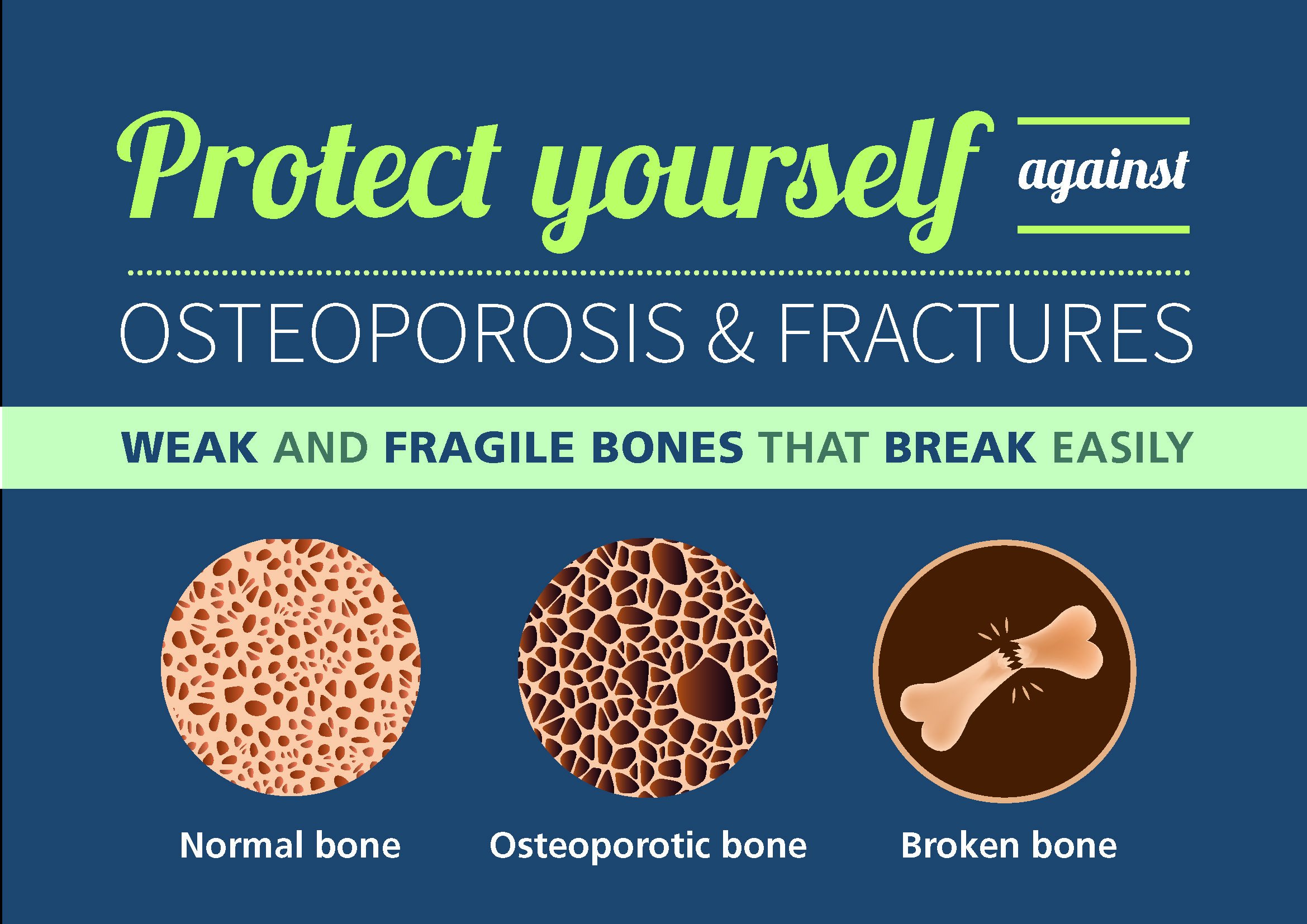 El mejor alimento para la osteoporosis