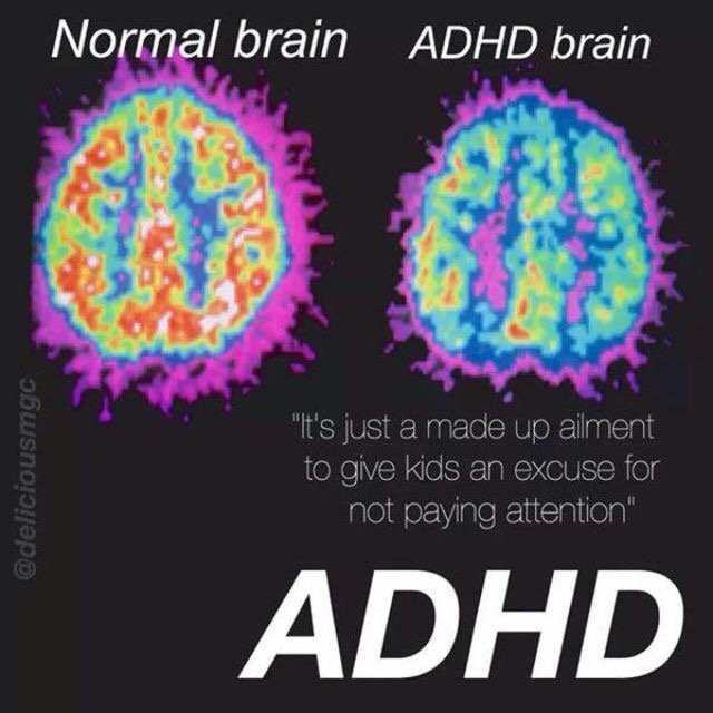 Attention disorders. ADHD Brain. ADHD арт. ADHD Brain differences. ADHD Brain pic.