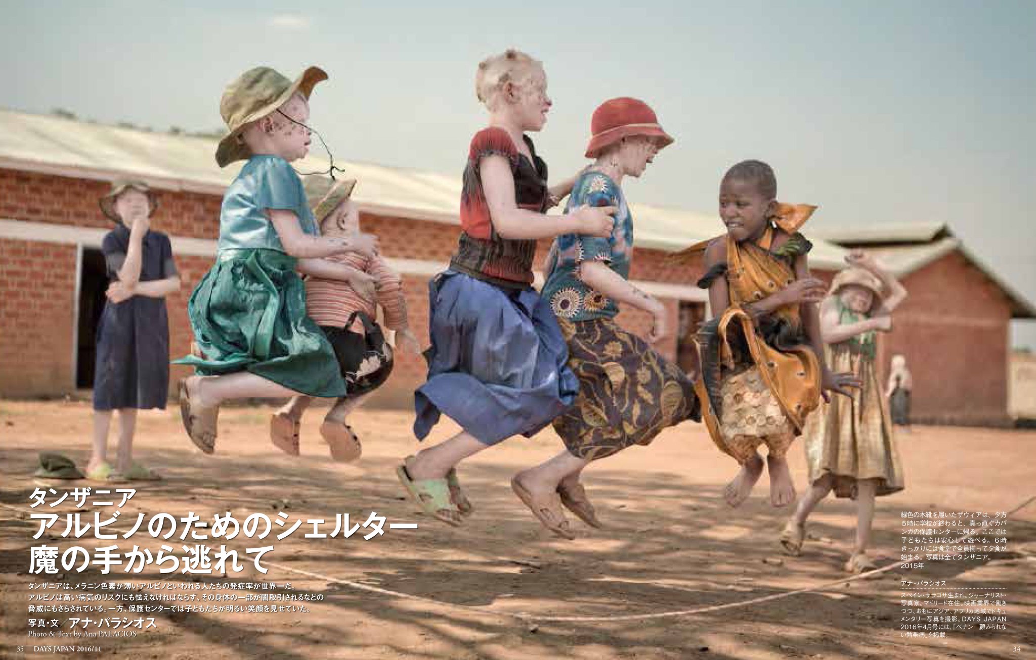 Days Japan 本日発売１１月号 タンザニア アルビノたちのシェルター魔の手から逃れて 高い病気のリスク その身体の一部が闇取引されるなどの脅威にさらされるアルビノと呼ばれる人たち タンザニアにある保護センターでの子どもたちの明るい笑顔と暮らしを