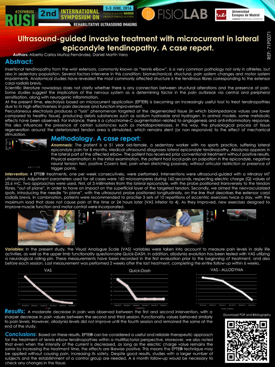 ionclinics's tweet photo. Ejemplo abstract tto de tendinopatías con #electrolisispercutanea #epte presentado en distintos congresos. @muscletechnetwo @RUSI2016 https://t.co/sSgZSDTmu8